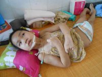 Bị cửa cuốn kẹp nhiều giờ, bé gái chết não